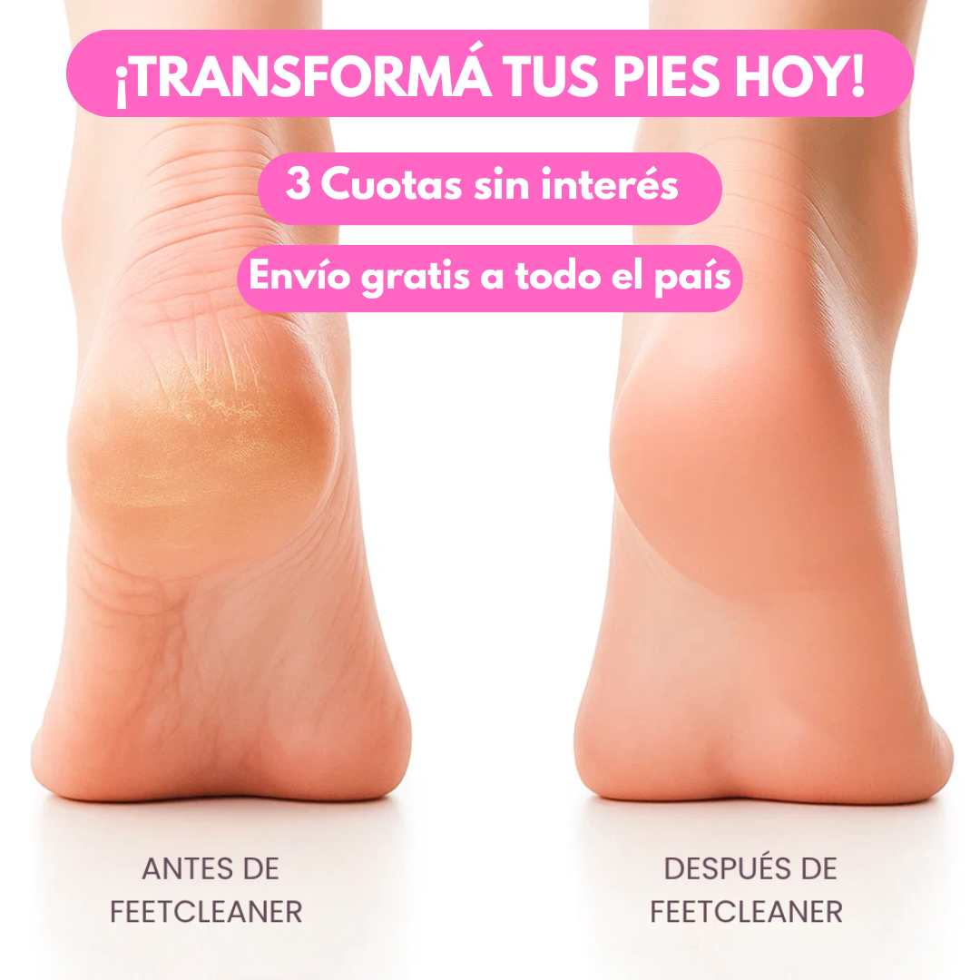 FeetCleaner | ¡Pies perfectos desde casa!
